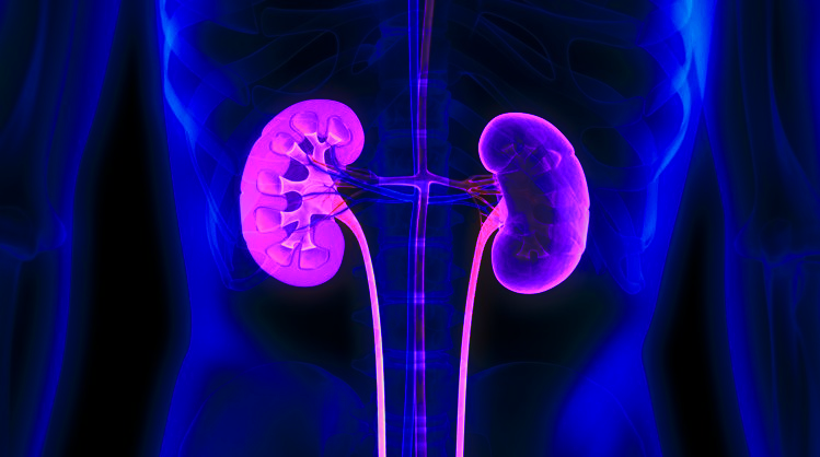 The Irreversible Kidneys